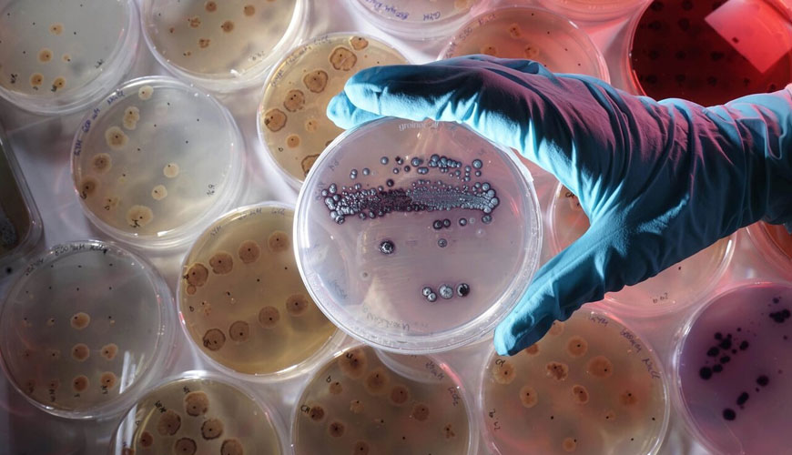 ASTM E1428 Streptomyce türleri (Pembe Leke Organizması) Tarafından Boyanmaya Karşı Polimerik Katılarda veya Üzerinde Antimikrobiyallerin Performansını Değerlendirmek için Test Standardı