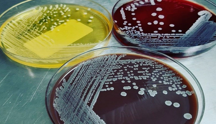ATCC 6538 Staphylococcus Aureus Testleri