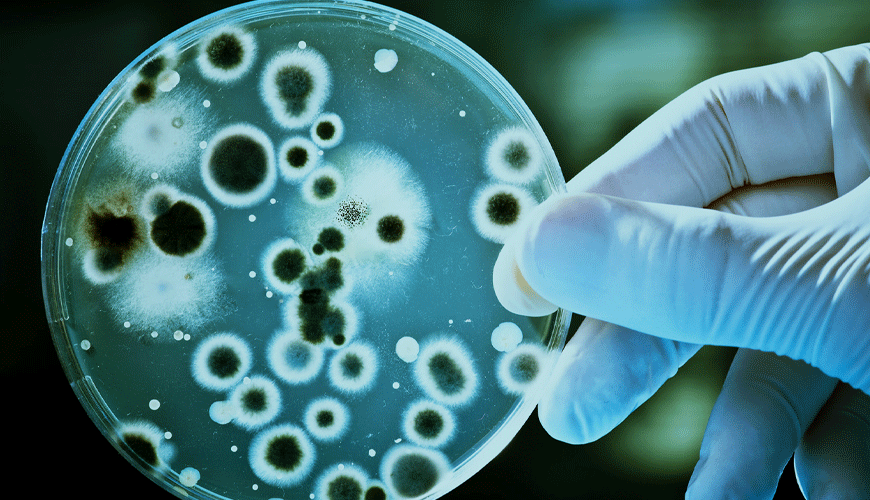 EN ISO 11737-1 Sağlık Bakım Ürünlerinin Sterilizasyonu - Mikrobiyolojik Yöntemler - Ürünler Üzerindeki Mikroorganizma Popülasyonunun Belirlenmesi