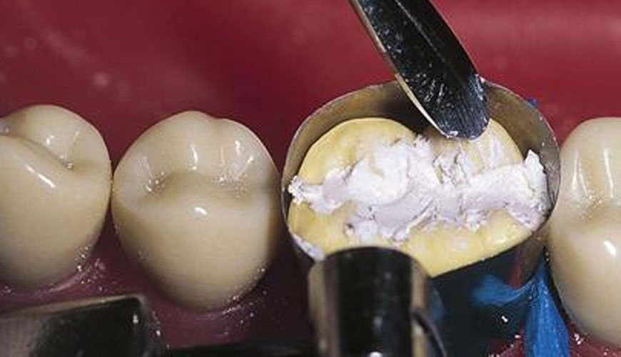 EN ISO 17304 Diş Hekimliği, Polimerizasyon Büzülmesi: Polimer Bazlı Restoratif Materyallerin Polimerizasyon Büzülmesini Belirleme Yöntemi