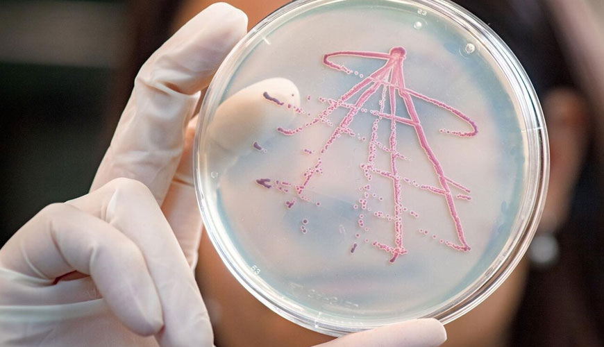 ISO 16649-2 Beta-Glukuronidaz Pozitif Escherichia Coli Sayımı Için Yatay Yöntem -Bölüm 2 - 5-Bromo-4-Kloro-3-Indolil Beta-D Kullanılarak 44°C İçinde Koloni Sayımı Tekniği -Glukuronid