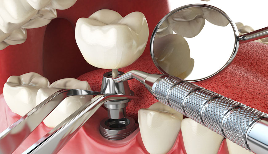 ISO 22674 Diş Hekimliği - Sabit ve Çıkarılabilir Restorasyonlar ve Apareyler için Metalik Malzemeler Test Standardı