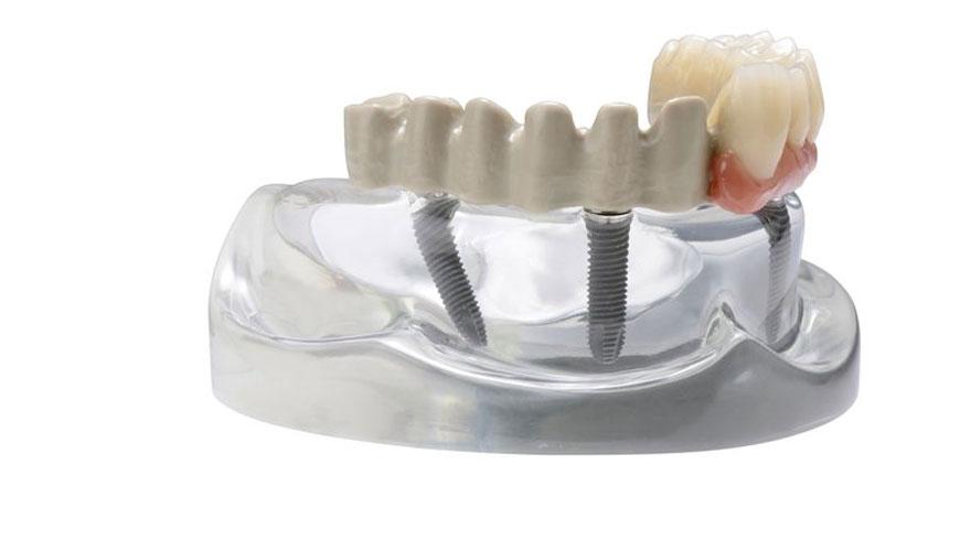 ISO 22794 Diş Hekimliği - Ağız ve Çene Cerrahisinde Kemik Dolgusu ve Büyütmesi için İmplante Edilebilir Malzemeler - Teknik Dosyanın İçeriği için Test Standardı