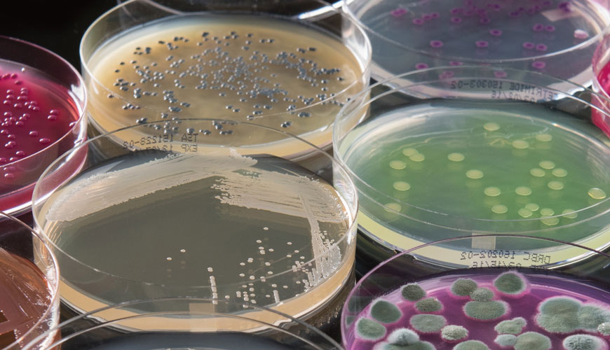 ISO 4833-2 Gıda Zincirinin Mikrobiyolojisi - Mikroorganizmaların Sayımı için Yatay Yöntem - Bölüm 2: Yüzey Kaplama Tekniği ile Koloni Sayımı Testi