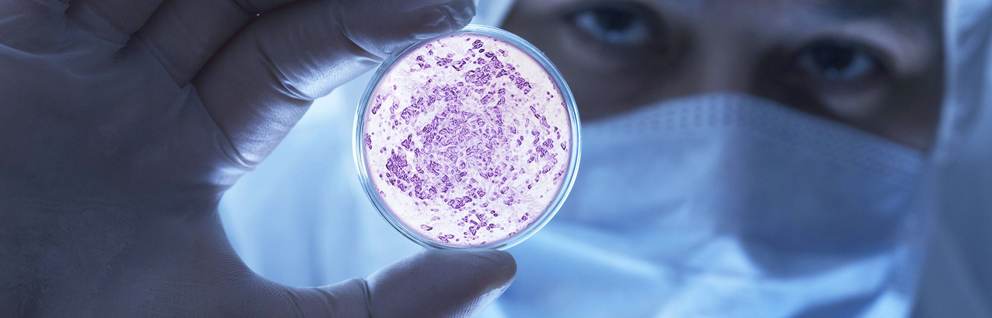 Kontaminasyon Analizleri